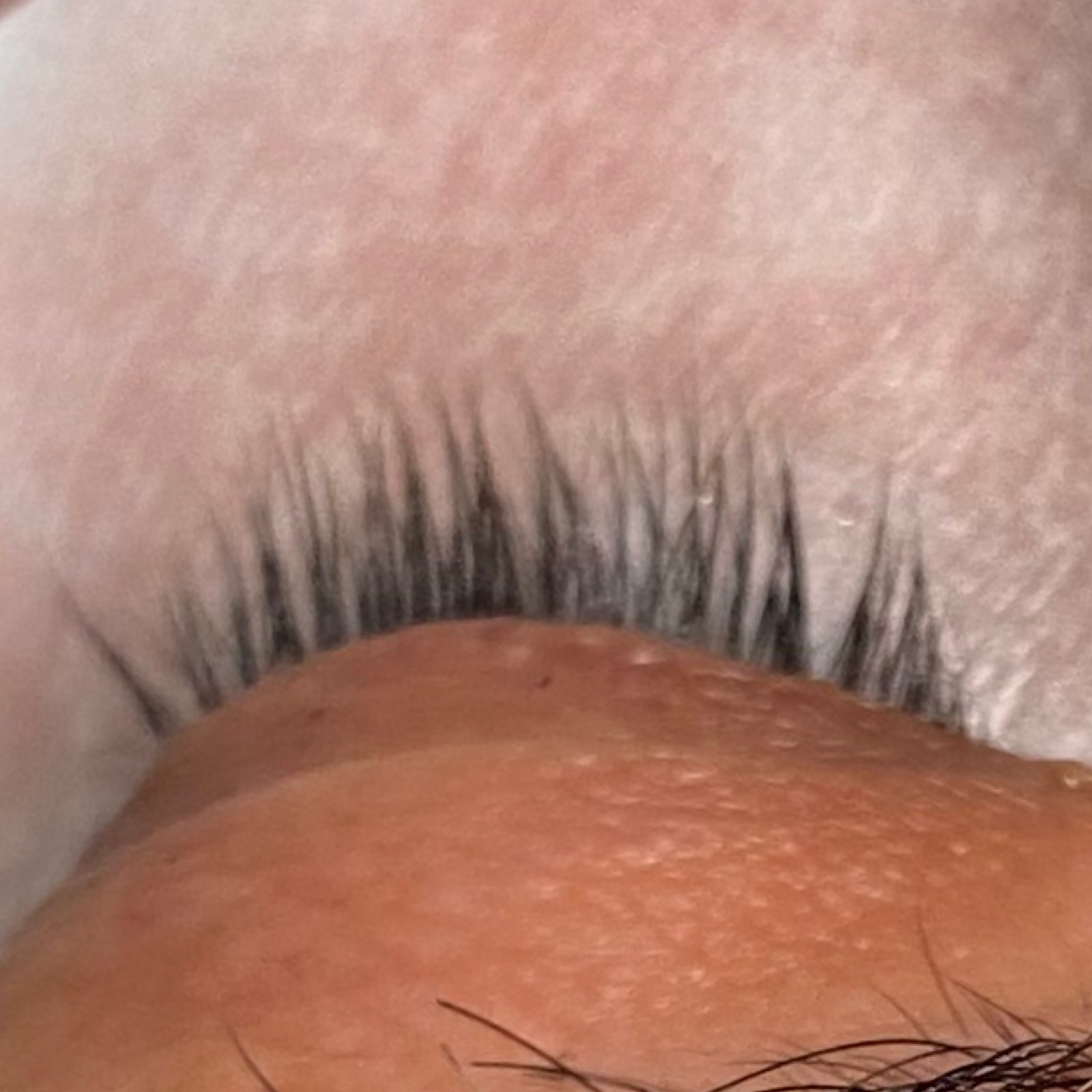 Lash Removal