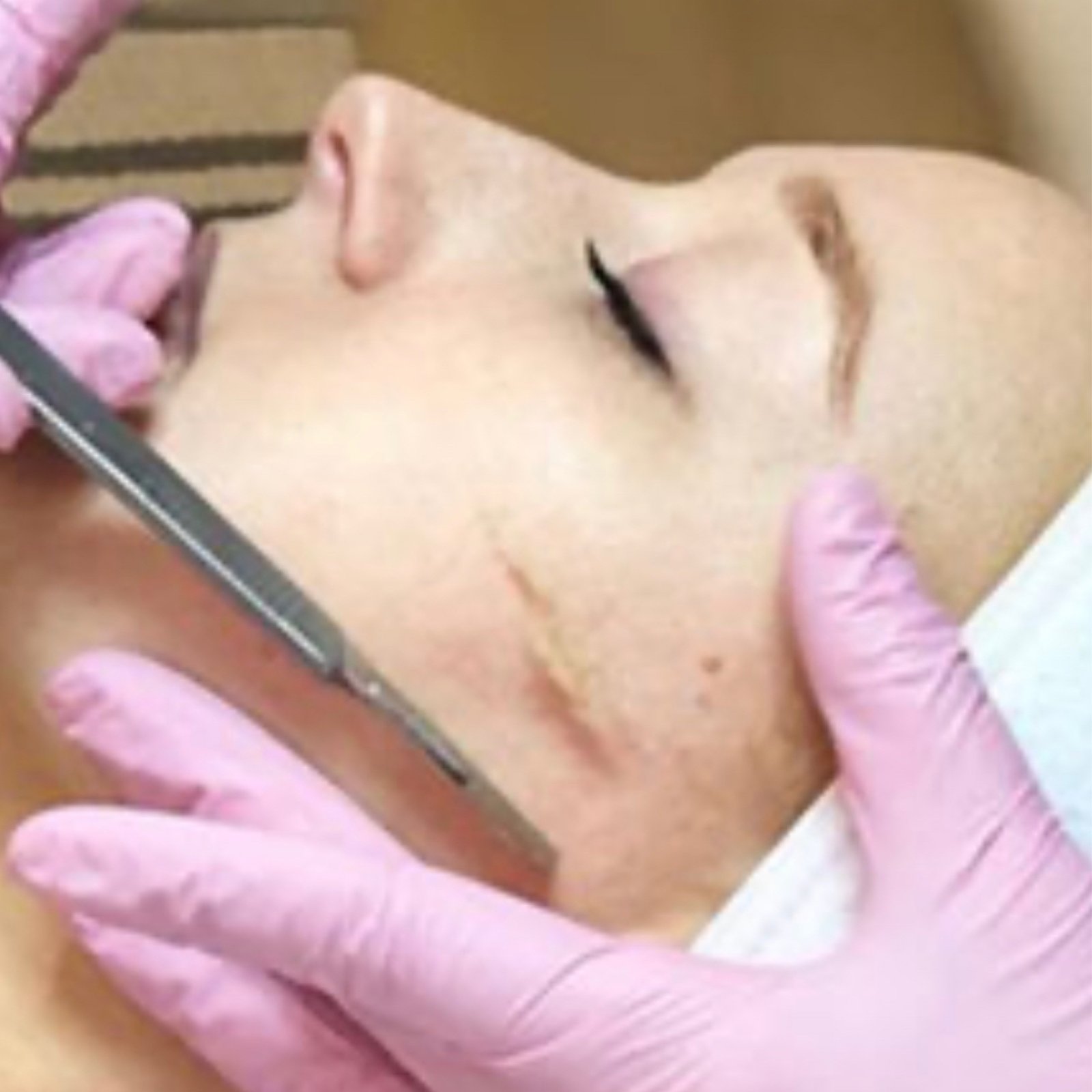 Dermaplaning Facial